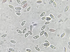 Macrocystidia