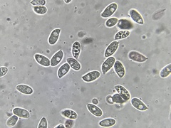 Macrocystidia