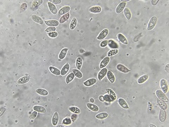 Macrocystidia