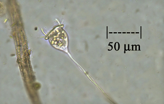 Vorticella