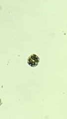 Micrasterias truncata