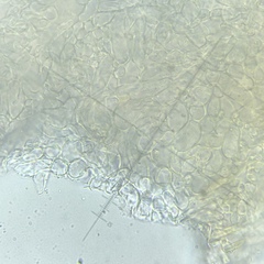 Arachnopeziza aurelia