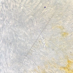 Arachnopeziza aurelia