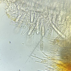 Arachnopeziza aurelia