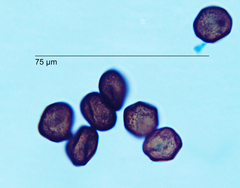 Anthracoidea heterospora