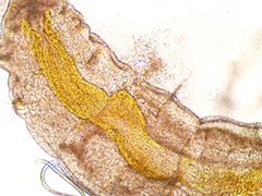 Manayunkia baicalensis