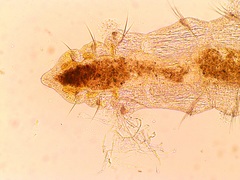Manayunkia