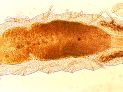 Manayunkia