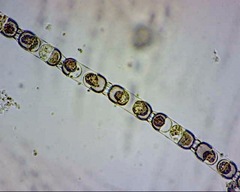 Stephanopyxis nipponica