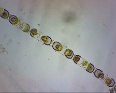 Stephanopyxis nipponica