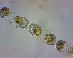 Stephanopyxis nipponica