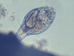 Bdelloidea