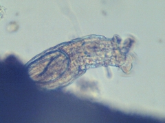 Bdelloidea