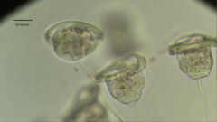 Pseudovorticella monilata