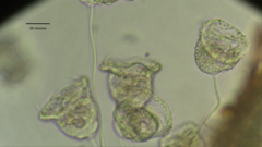 Pseudovorticella monilata