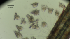 Pseudovorticella monilata