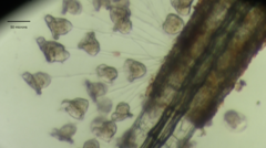 Pseudovorticella monilata