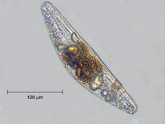 Cymbella