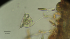 Vorticella