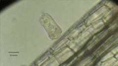 Pseudovorticella monilata