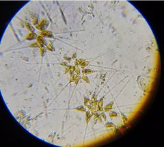 Asterionellopsis glacialis