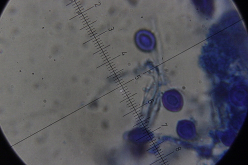 Granulobasidium vellereum image