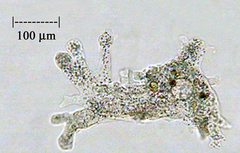 Amoeba