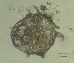 Centropyxis aculeata