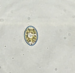 Cocconeis pediculus