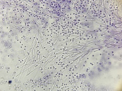 Helicogloea