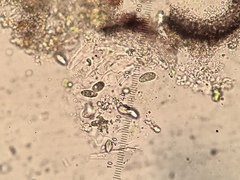 Verrucaria trabalis
