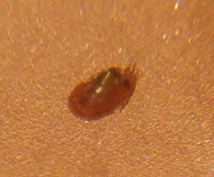 Acroloxus lacustris