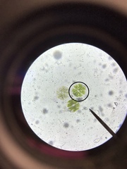 Micrasterias truncata