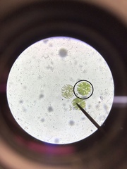 Micrasterias truncata