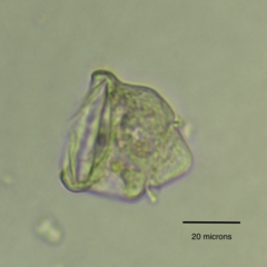 Vorticella