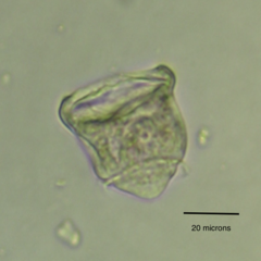 Vorticella