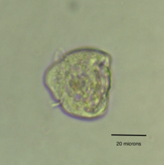 Vorticella