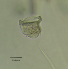 Vorticella