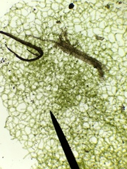 Hydrodictyon reticulatum