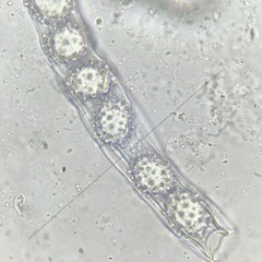 Genea verrucosa image
