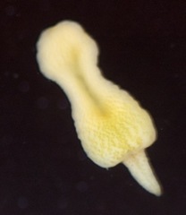 Sipuncula