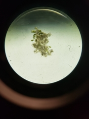 Micrasterias truncata