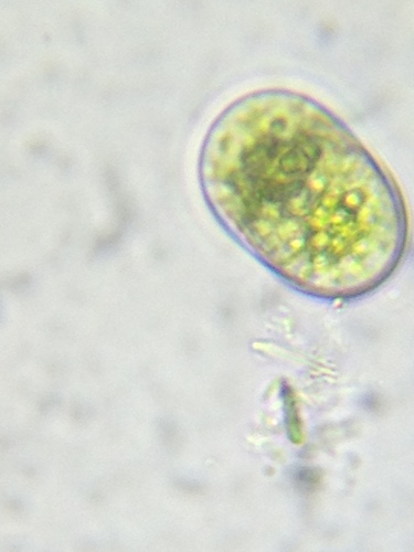 Cylindrocystis crassa