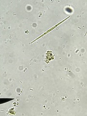 Fragilaria