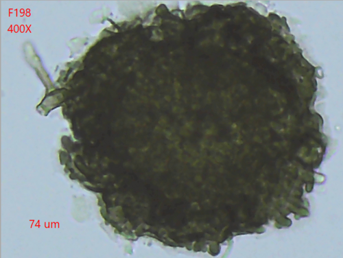 Boeremia hedericola