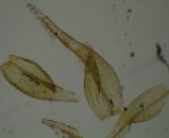 Orthotrichum tasmanicum