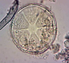 Actinoptychus senarius