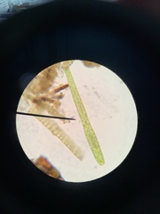 Pleurotaenium trabecula