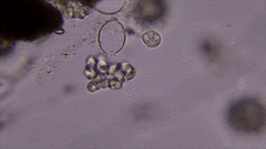 Estiolamento (Pythium spp.)