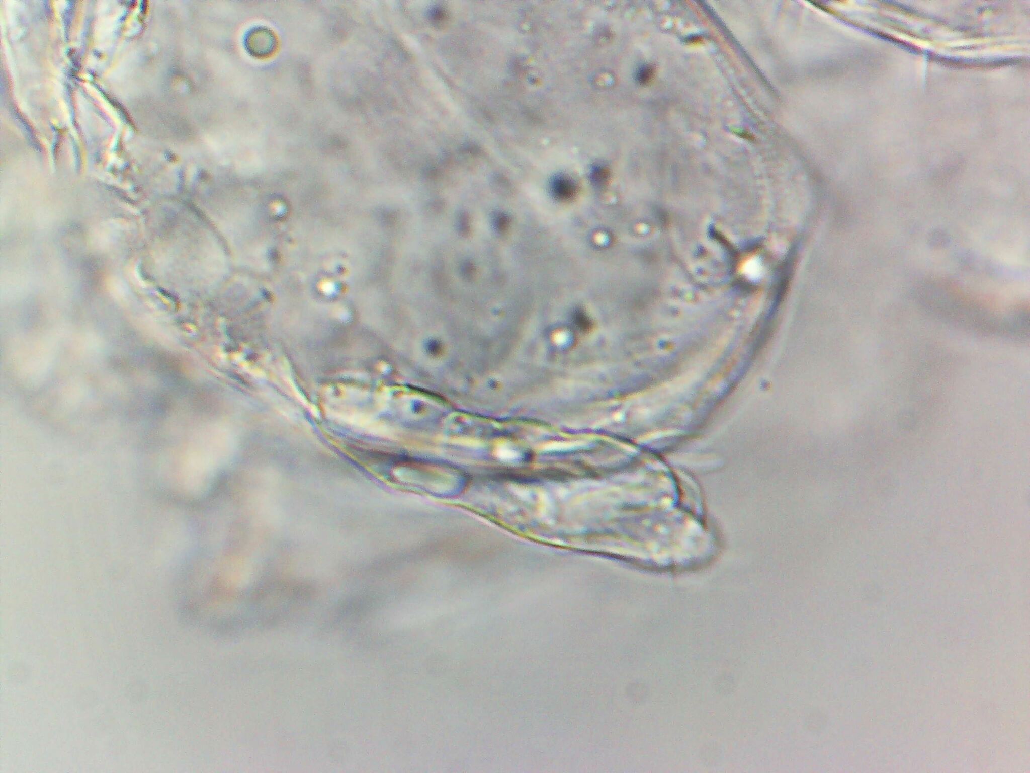 Megalothorax minimus V.Willem, 1900